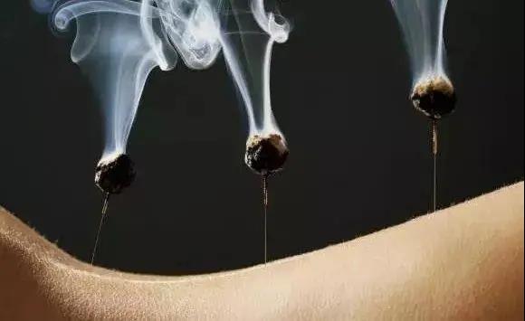 艾灸不是藥，調(diào)的不是病，央視為艾灸正名，讓我們正視艾灸