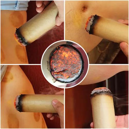 灸溫，到底是燙的好還是溫的好？為什么有的人感覺不到熱?