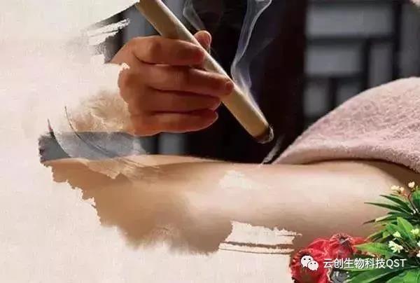 艾灸你知道多少？關(guān)于艾灸那些不得不說的事