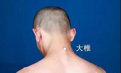 春天灸灸背，能活一百歲~