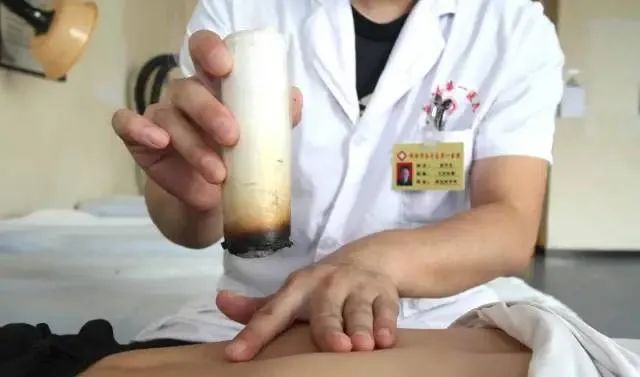 產(chǎn)后艾灸一個(gè)月，十年少生??！ 