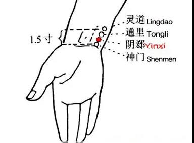 睡覺(jué)愛(ài)出汗，艾灸這幾個(gè)穴位