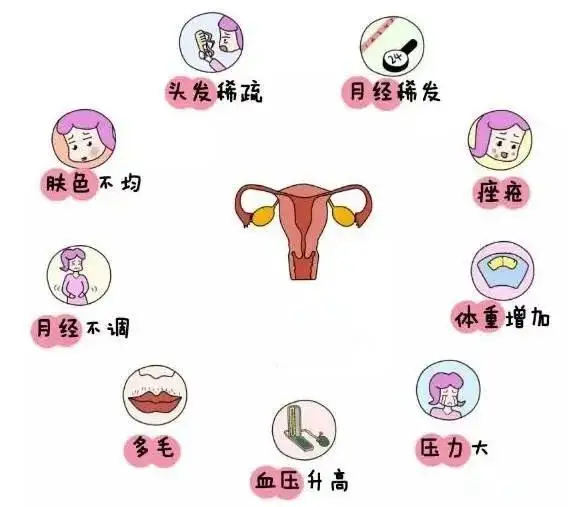 10個女人就有1個患多囊！被它纏上不要怕，艾灸幫你調(diào)“多囊”！